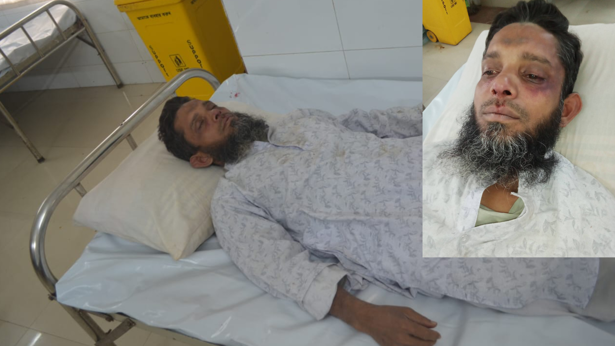 বরিশাল কাশিপুরে বিএনপি নেতার হামলায় জামায়াতকর্মী গুরুতর জ’খ’ম শেবাচিমে ভর্তি