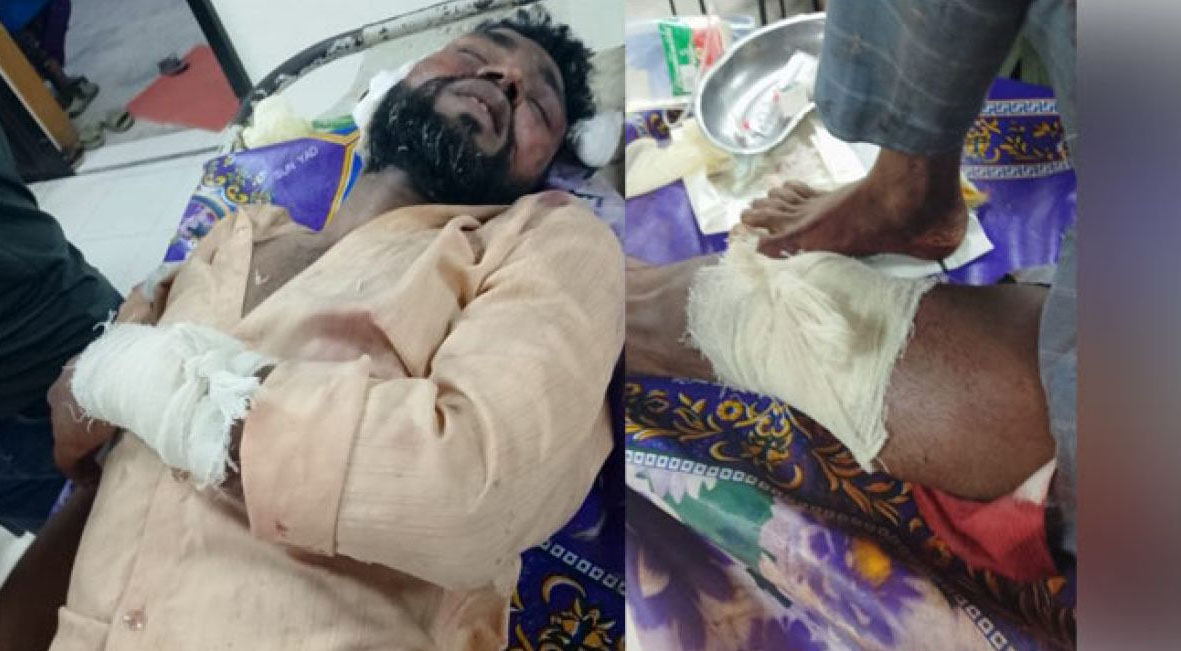 কেরানীগঞ্জে যুবককে নির্যাতনের অভিযোগে মামলা, সংকটাপন্ন ভুক্তভোগী